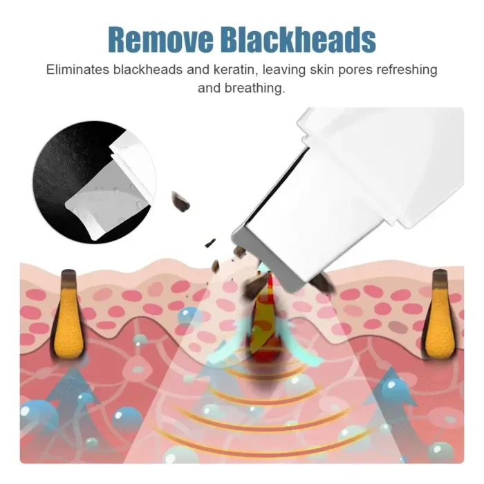 Vibrate Skin Scrubber - Image 5